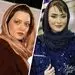 تغییر چهره بهنوش طباطبایی + عکس