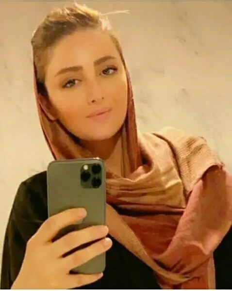 تغییر چهره شیلا خداداد + عکس
