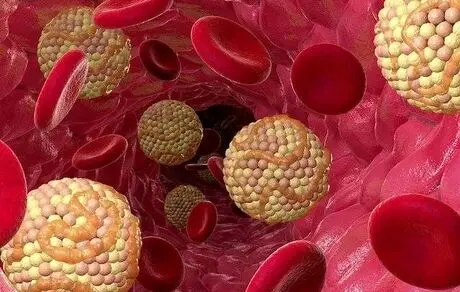 چربی خون بالا چه بلای بر سرمان می‌آورد؟