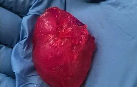 ساخت قلب انسان با استفاده از سلول انسانی و چاپگر سه‌بعدی+عکس
