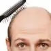 نسخه طلایی برای درمان ریزش مو