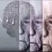 چربی‌های ترانسی که باعث ابتلا به آلزایمر می‌شود