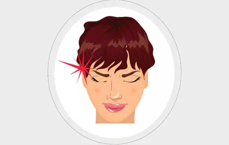 8 نوع سردرد و چگونگی رفع آن‌ها