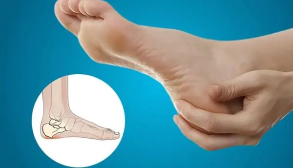پیشنهاد هایی برای مبتلایان به خارپاشنه