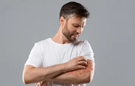 برخی از علائم مشکلات قلبی بر روی پوست آشکار می‌شوند