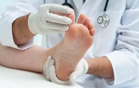 هر آنچه درباره زگیل‌ها باید بدانید