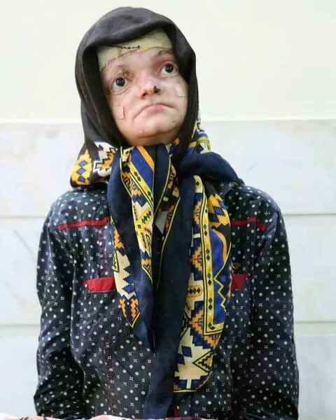 پروانه‌هایی که در آتش تحریم می‌سوزند +عکس