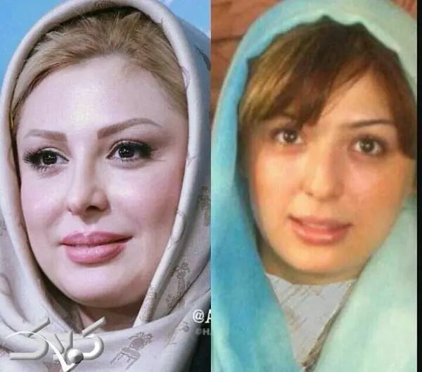 نیوشا ضیغمی در گذر زمان + عکس