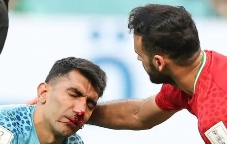 بیرانوند و خطر از دست دادن دربی!