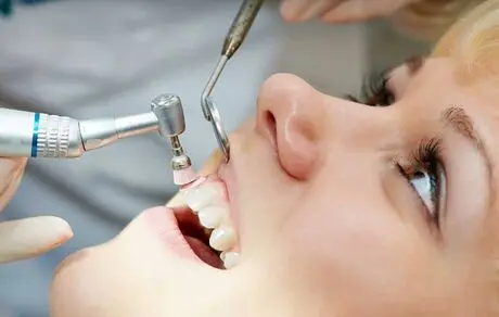 آیا جرم گیری، دندانهایتان را لق می کند؟