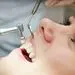 آیا جرم گیری، دندانهایتان را لق می کند؟