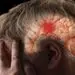 هشدار؛ بدخوابی نشانه سکته مغزی خفیف است