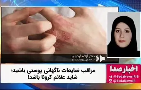  علائم جدید کرونا روی پوست صورتتان!
