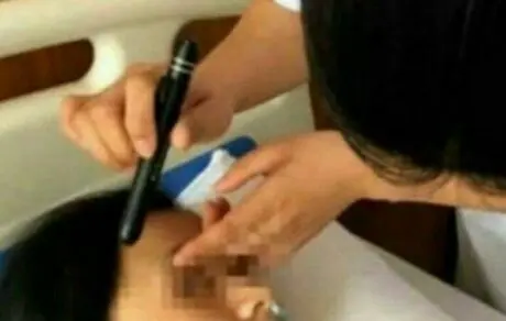دختر جوان بعد از بازی با موبایل کور شد! +عکس