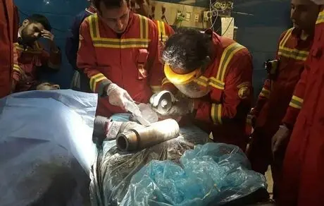 چرخ‌گوشت دست کارگر جوان را بلعید