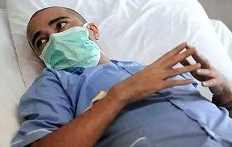 شاخ مرد انگلیسی از بدنش جدا شد