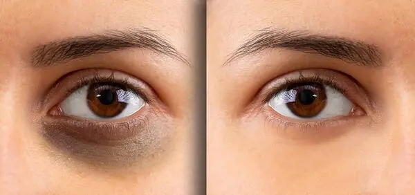 تشخیص 10 بیماری از روی چهره انسان!/ چهره‌های مردم می‌تواند به عنوان اولین خط دفاعی عمل کنند 