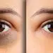 تشخیص 10 بیماری از روی چهره انسان!/ چهره‌های مردم می‌تواند به عنوان اولین خط دفاعی عمل کنند 