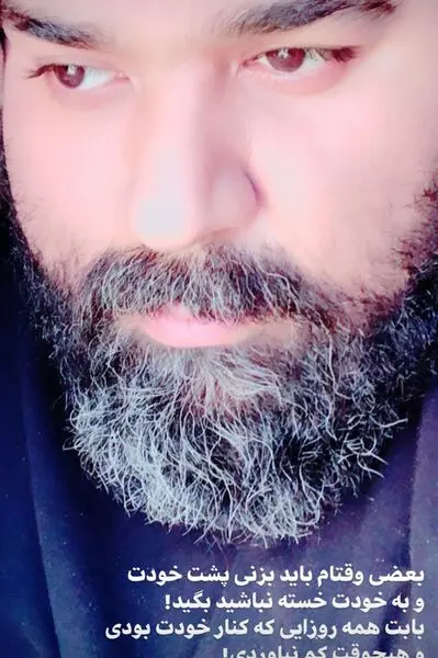 رضا صادقی پیر شد + عکس