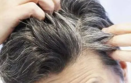 چرا افراد دچار سفیدی زودرس مو می‌شوند؟