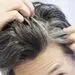 چرا افراد دچار سفیدی زودرس مو می‌شوند؟