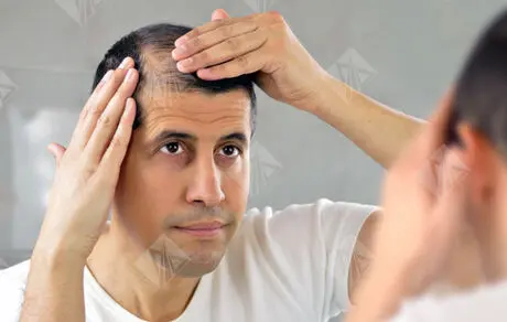 تغییرات موهای شما نشان دهنده بیماری شماست