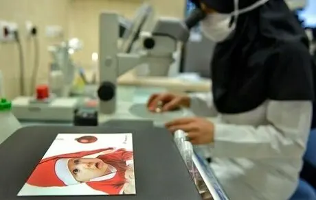 عوارض فریز کردن تخمک و هزینه انجام آن
