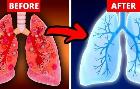 با روش‌های طبیعی ریه‌ها را پاکسازی کنید