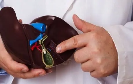 دفع سنگ کیسه صفرا با طب سنتی