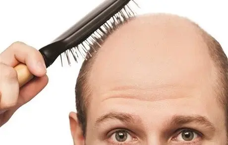 ریزش چند تار مو در طول روز طبیعی است؟