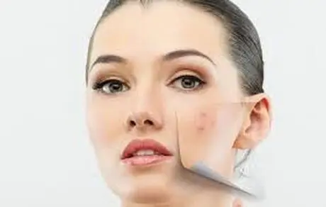 روش هایی برای رهایی از لکه‌ های پوستی