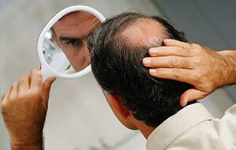 جوشانده ضد ریزش و رویش مجدد مو