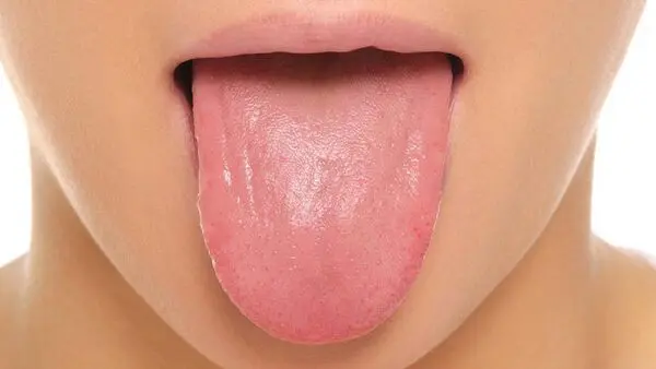 علت التهاب زبان