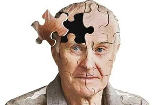 پیش بینی ترسناک از آمار آلزایمر در کشور؛ ۲ دهه تا ۲ برابر شدن آمار آلزایمر