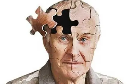پیش بینی ترسناک از آمار آلزایمر در کشور؛ ۲ دهه تا ۲ برابر شدن آمار آلزایمر