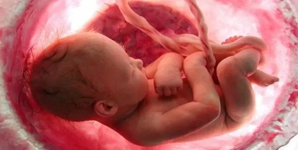 سقط جنین قانونی شد