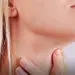 بایدها و نبایدها در کم کاری تیروئید