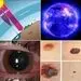 هشدار درخصوص میزان تابش اشعه «ماورای بنفش» برای تهران


