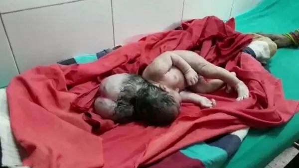 از تولد نوزاد سه‌سر در هند تا فرونشست زمین و آتش سوزی در برج پرند/ قتل همسر و فرزند با تبر