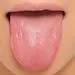 چه چیزی موجب بروز لکه های سفید و گرد روی زبان می شود؟