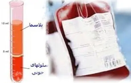 چگونه پلاسما اهدا کنیم؟