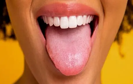 تغییر رنگ زبان خبر از کدام بیماری می‌دهد؟