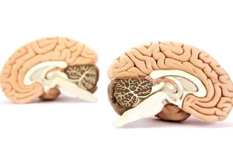 مغز افراد باهوش و عادی متفاوت است