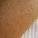 نکاتی درباره پوست مرغی یا کراتوز پیلاریس