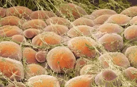 آشنایی با چربی قهوه ای بدن