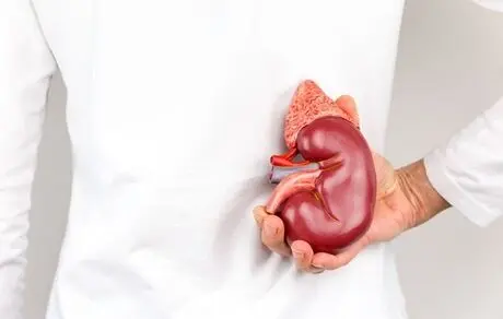 آقایان برای اهدای کلیه بهترند وعلل اصلی ایجاد سنگ کلیه