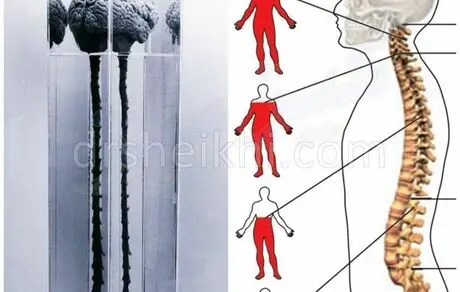 تشخیص زودهنگام سرطان پستان با این لباس امکان پذیر می شود