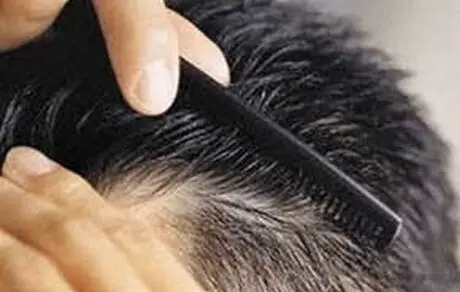 چرا موها زود سفید می شود؟