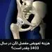 هزینه تعویض مفصل لگن