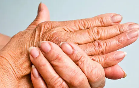 کاهش درد مفاصل با تغذیه صحیح